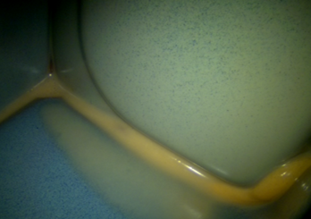 Sealed gap in the cavity